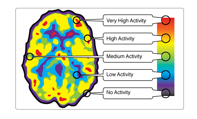 Rugg, 1997; Gazzaniga, 1995; Seren, 1993; McCarthy y Warrington, 1994; Marshall, 1996