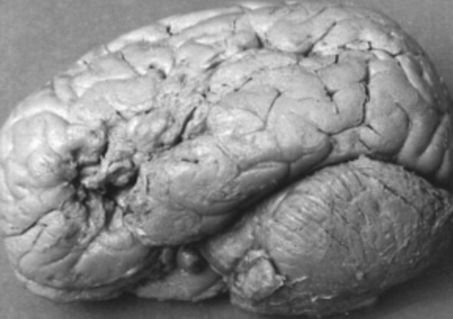 APORTE DE PAUL BROCA