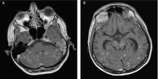 Miller y Cummings 1998