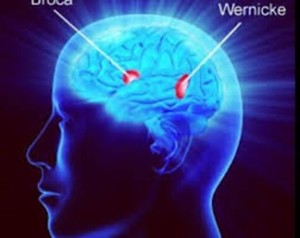 AFASIAS DE DOS TIPOS