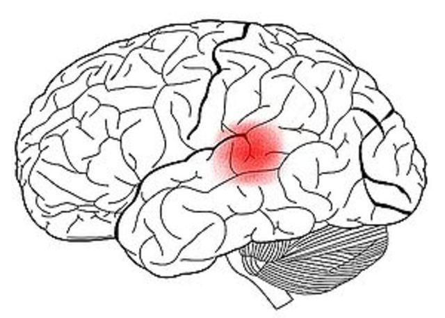 EL Lenguaje y su localización en el cerebro, Karl Wernicke