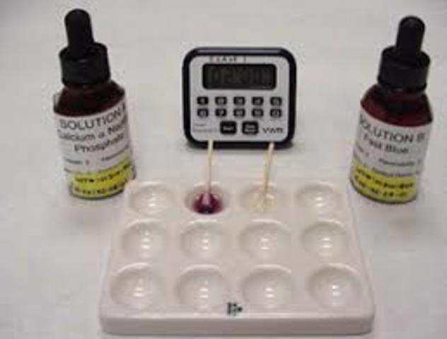 Acid phosphate tests