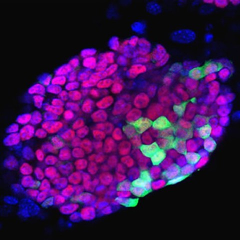 células madres embrionarias