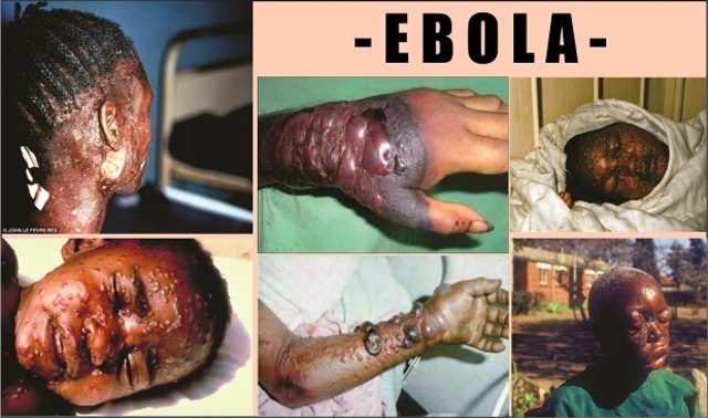 Ebola