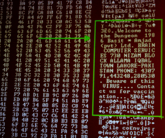 Primera epidemia de un virus Brian