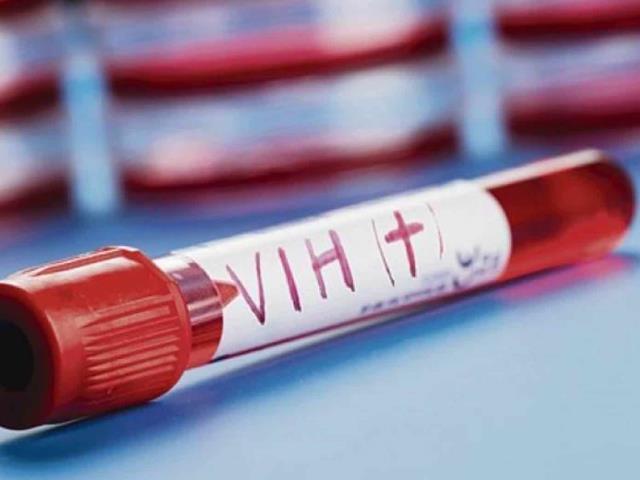 Se crean módulos de detección de anticuerpos contra el VIH en México.