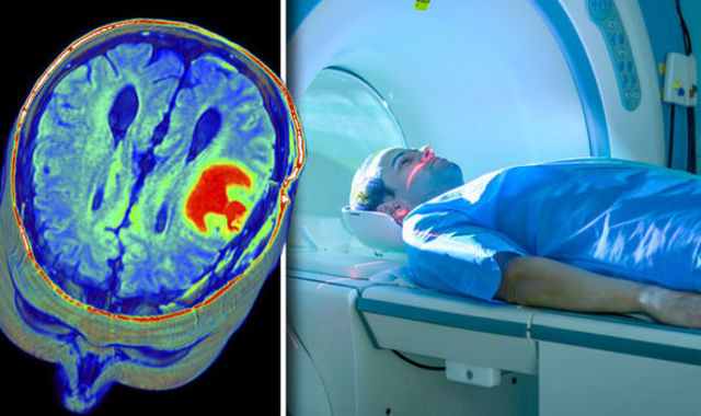 Magnetic resonance imaging aka MRI