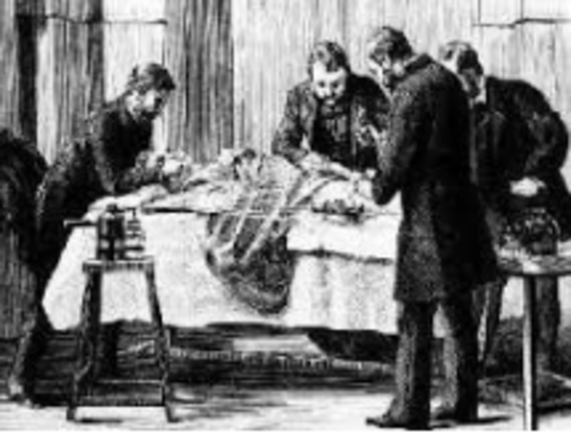 Los médicos lo describen como "una sofocación por desplazamiento de la matriz"