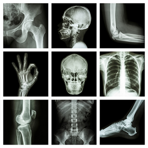 X-Rays