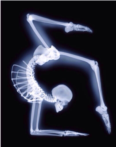 X-Rays