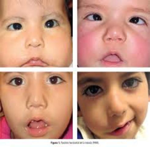 Kleist y Poppelreuter