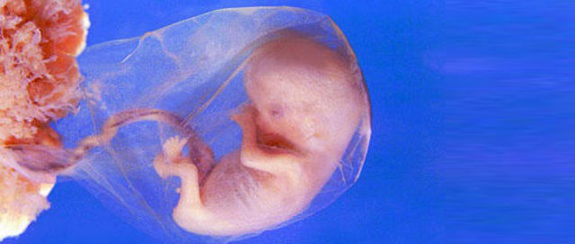 Month 3 of Pregnancy