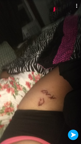 when it stared to get worse