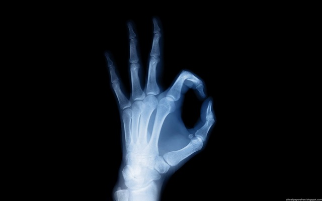 First X-ray perfomed