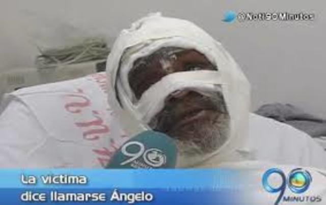 Quemados vivos dos indigentes en Colombia