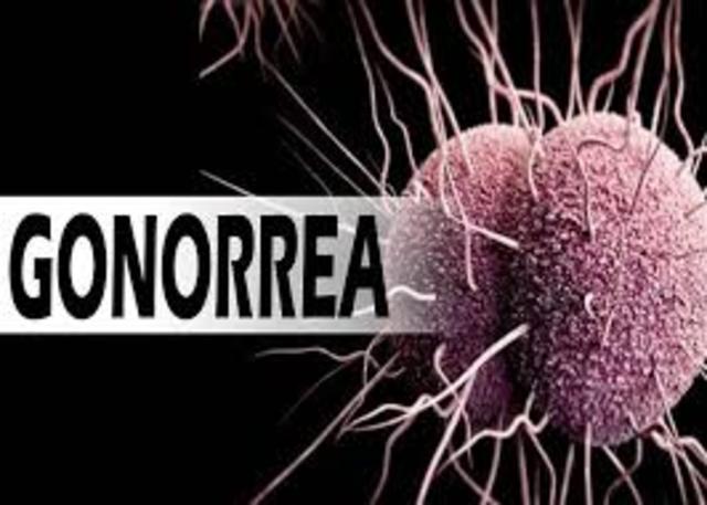 Gonorrea