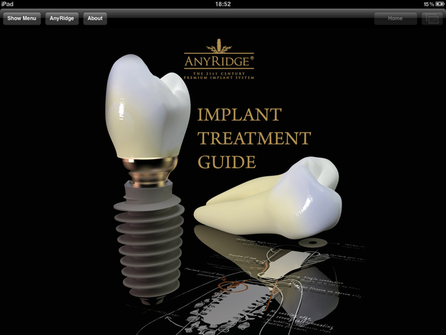 Implant Treatment Guide