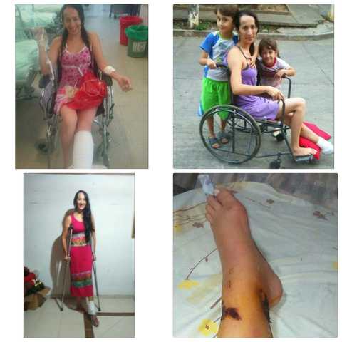 Accidente de Tránsito y Separación