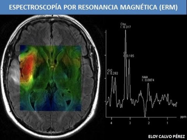 Espectroscopía por Resonancia Magnética
