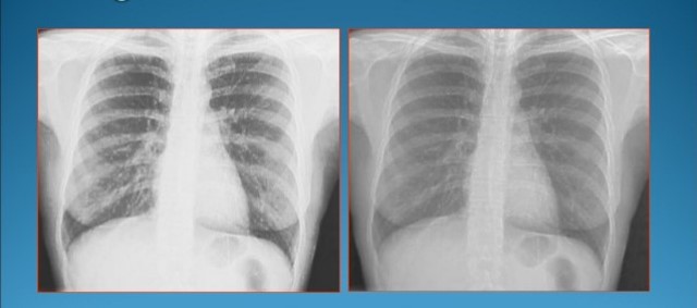 El uso del Ultrasonido de Alta Frecuencia en Problemas Marítimos