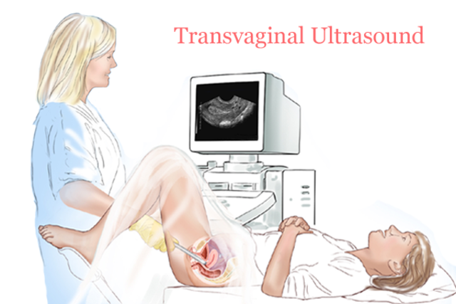 Me hicieron mi primer ultrasonido vaginal en el Centro Médico de Toluca