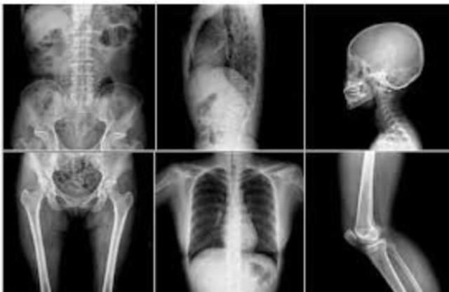 Rayos X en la Actualidad