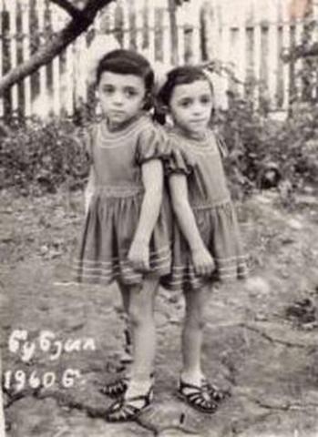 First Successful Separation of Siamese Twins