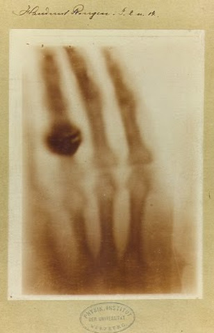 La primera imagen radiográfica al cuerpo humano.