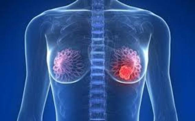 Radiologia Artificial