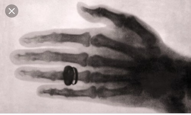 Principios de Radiología