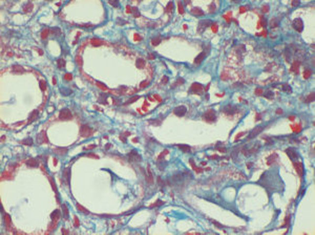 Mapa provisional del Genoma Humano.