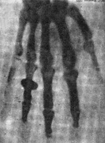 1.Descubrimiento de la Radiología