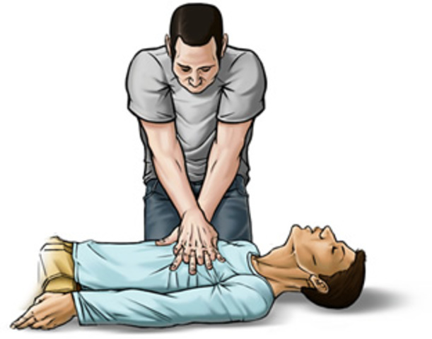 Técnicas de reanimación