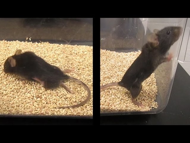 Células Madre Vs Esclerosis Múltiple.