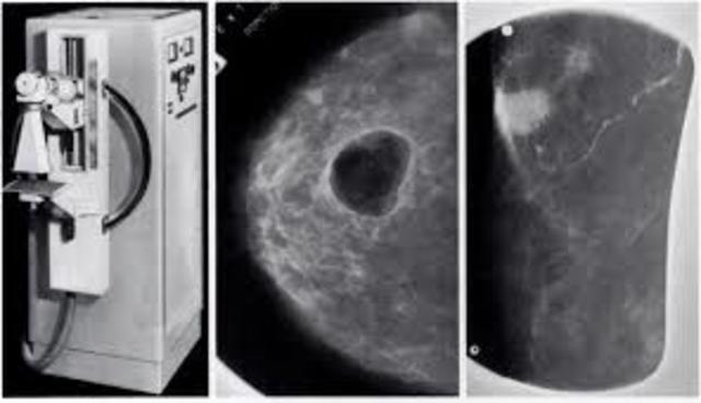 Investigación de Mamografia