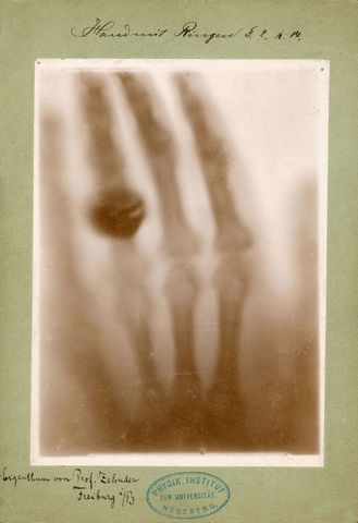 Primera Radiografía