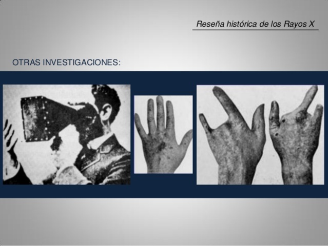 Guido Holzknecht. (1872-1931)