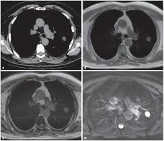 La resonancia magnética