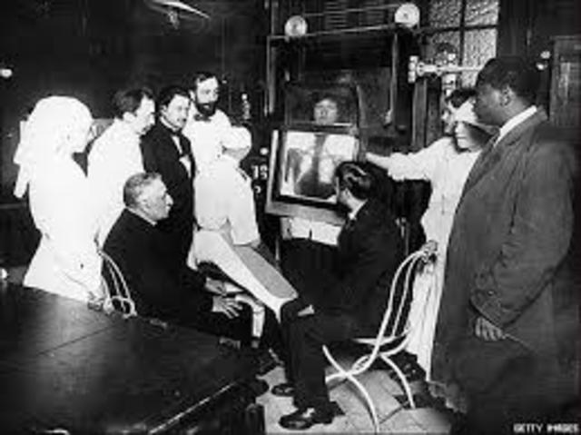 Investigación de los rayos x