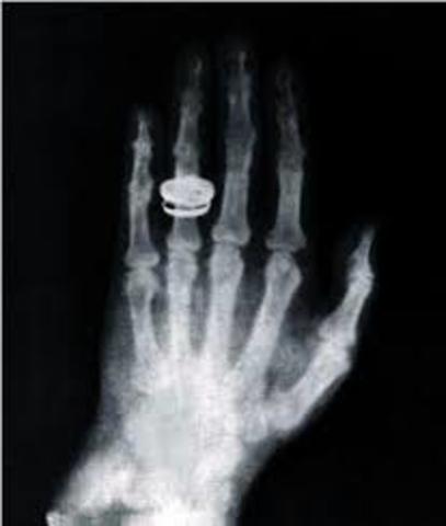 Primera Radiografía