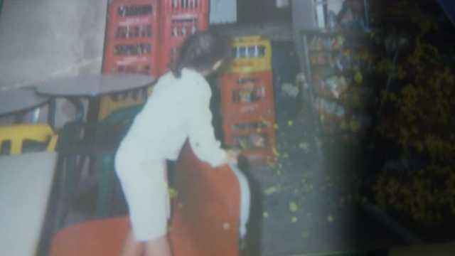 DEFECTO DE MI NIÑEZ