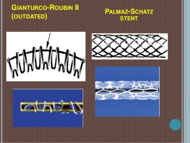Stent Gianturco Roubin