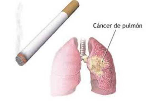 Cáncer de Pulmón
