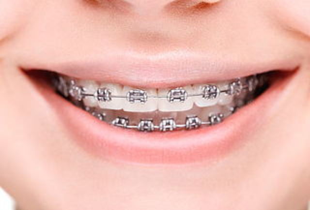 Comienza a Trabajar con Aceros Inoxidables