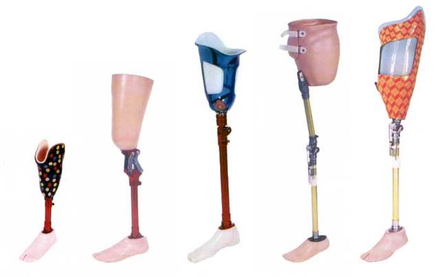 Dispositivo de Vidrio en Prótesis