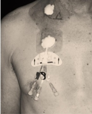 Padre de la nutrición parenteral