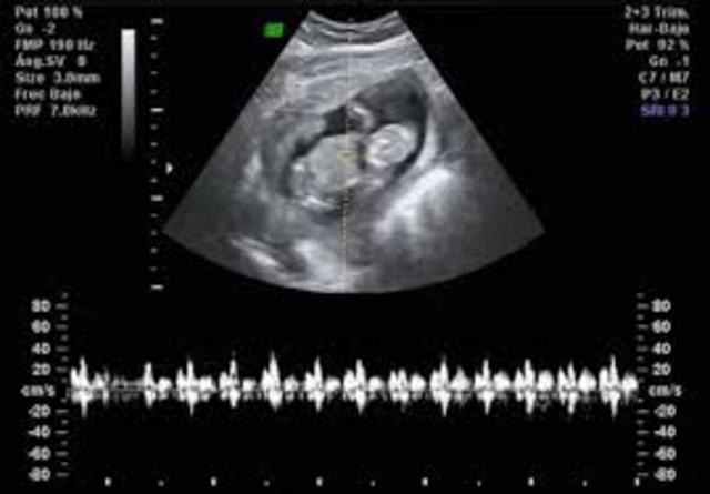 TENER MI 1ER HIJO A LOS 36