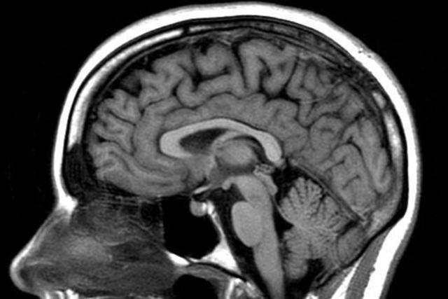 Cuál es la evolución del cerebro humano