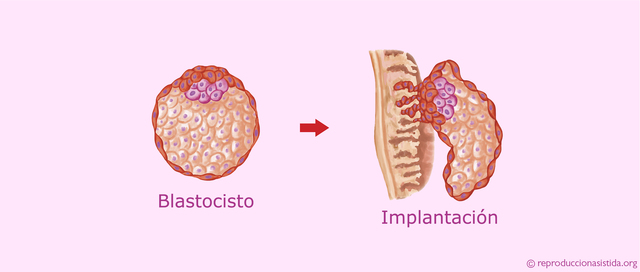 Implantación ( semana 1)