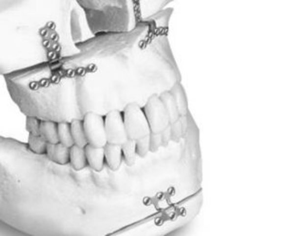 Primeros Estudios de Compatibilidad Biológica de los Materiales